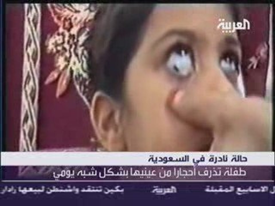 Incroyable fille qui pleure des cailloux!!