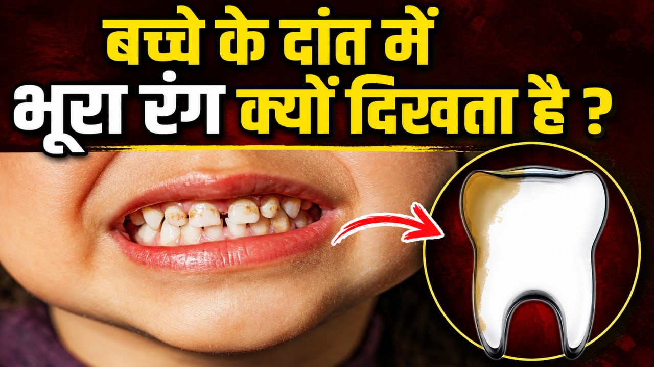 Teeth Brown Stain Removal: बच्चे के दांत में भूरा धाग होने का कारण,इलाज क्या है ?
