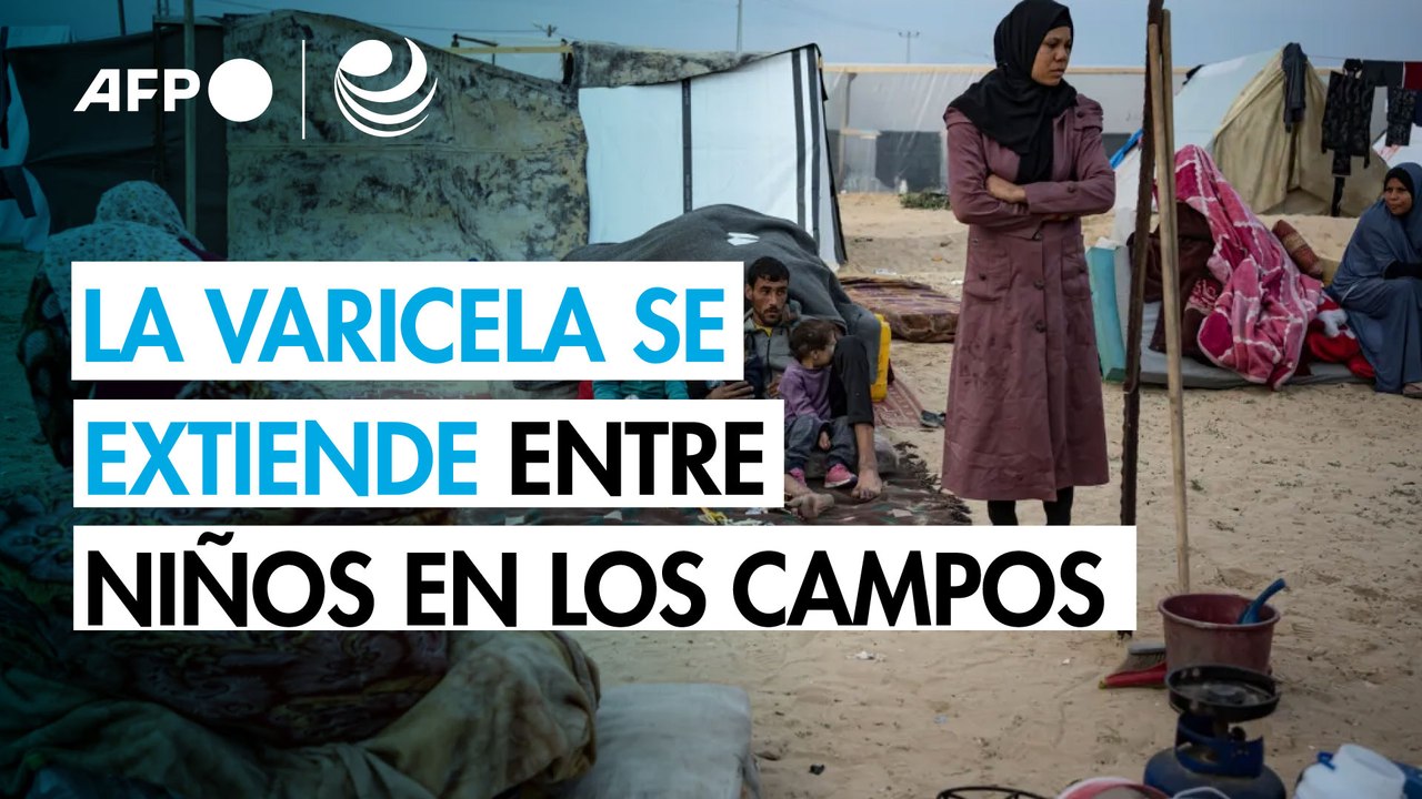 La varicela se propaga en los saturados campamentos de Gaza