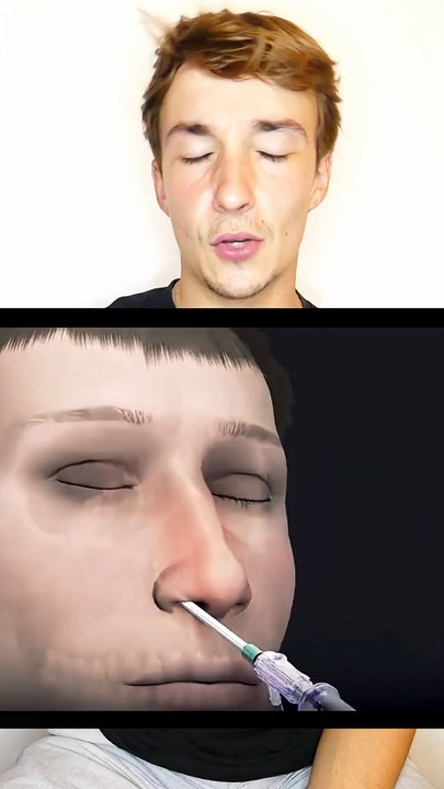 Sinusite