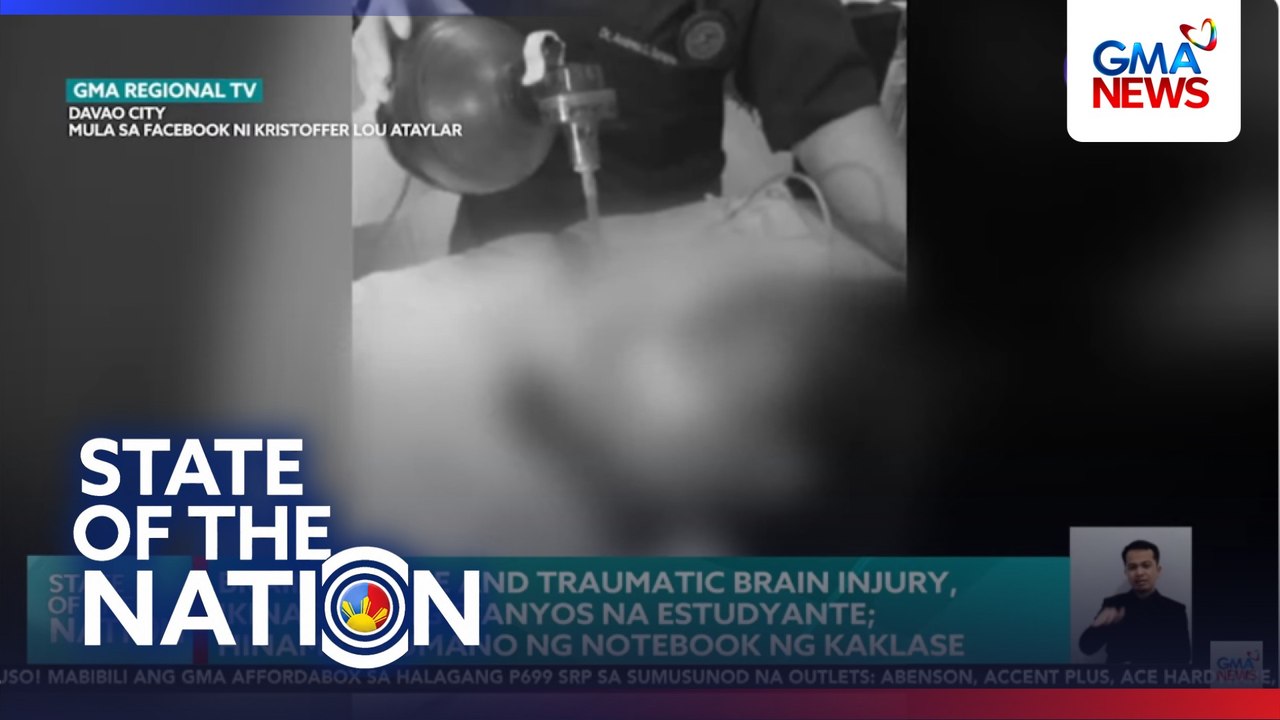Brain failure and traumatic brain injury, ikinasawi ng 8-anyos na estudyante; hinampas umano ng notebook ng kaklase | SONA
