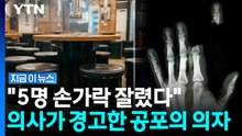 고깃집에 흔히 있는데 "내가 본 환자만 5명"…절단 사고 주의보 [지금이뉴스] / YTN