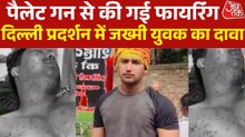 'दिल्ली में पैलेट गन से की गई फायर‍िंग, जख्मी प्रदर्शनकारी का दावा, देखें