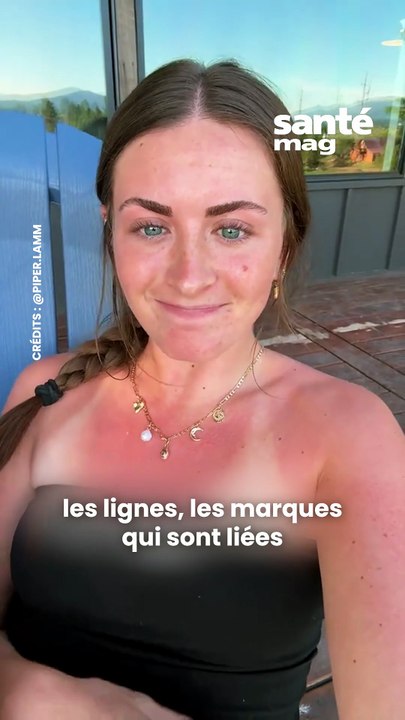 La tendance "coups de soleil" décryptée par une...