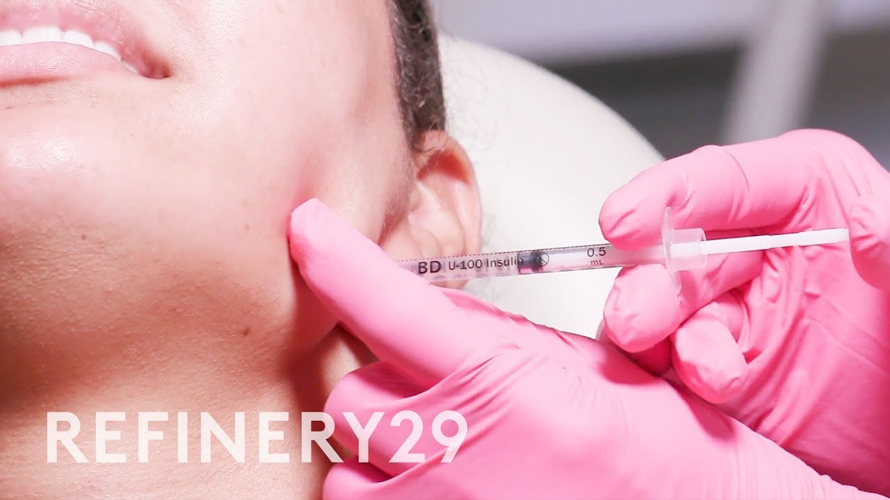 I Tried Jawline Contour & Masseter Botox | Macr...