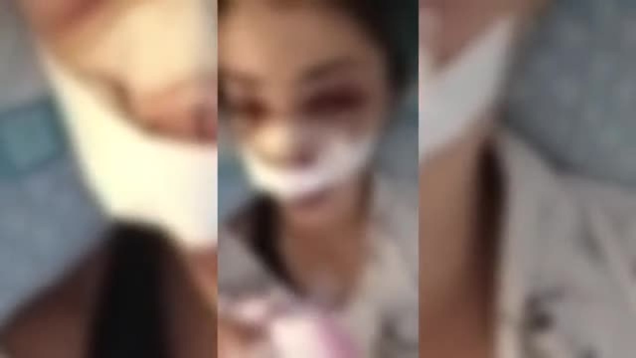 Bari, ragazza presa a calci al Parco Rossani: «La gente guardava e non faceva nulla. Ho chiamato da sola i soccorsi»