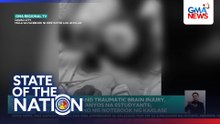 Brain failure and traumatic brain injury, ikinasawi ng 8-anyos na estudyante; hinampas umano ng notebook ng kaklase | SONA