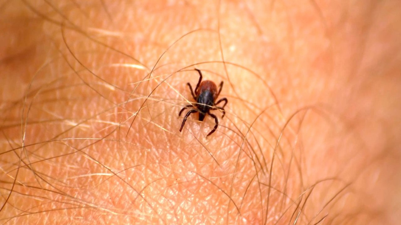 CDC: Tick-borne alpha-gal syndrome could affect up to 450,000 Americans