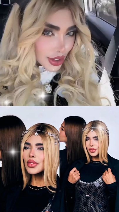 La Barbie colombiana ahora tiene los ojos rojos