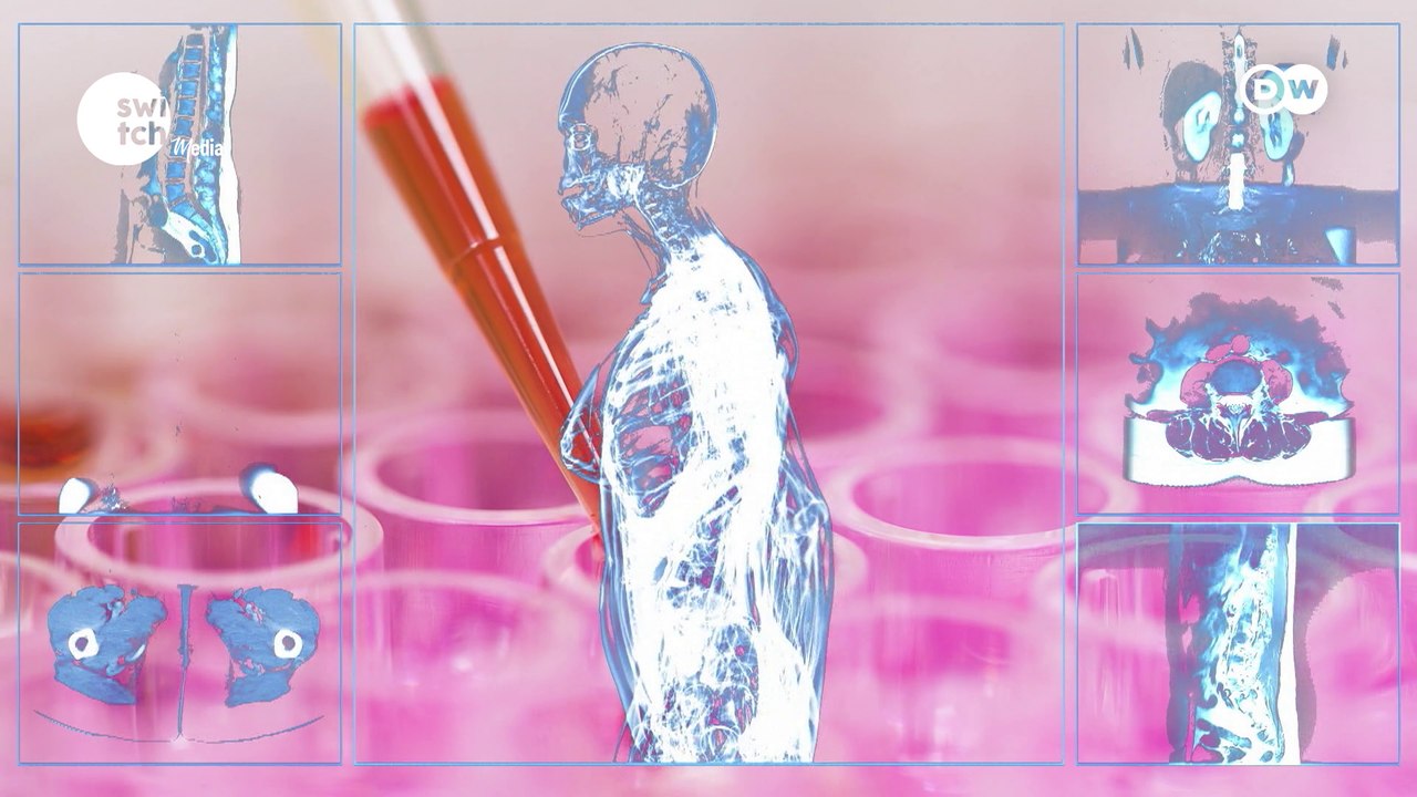 Making cancer cell therapy affordable || DW's Tomorrow Today