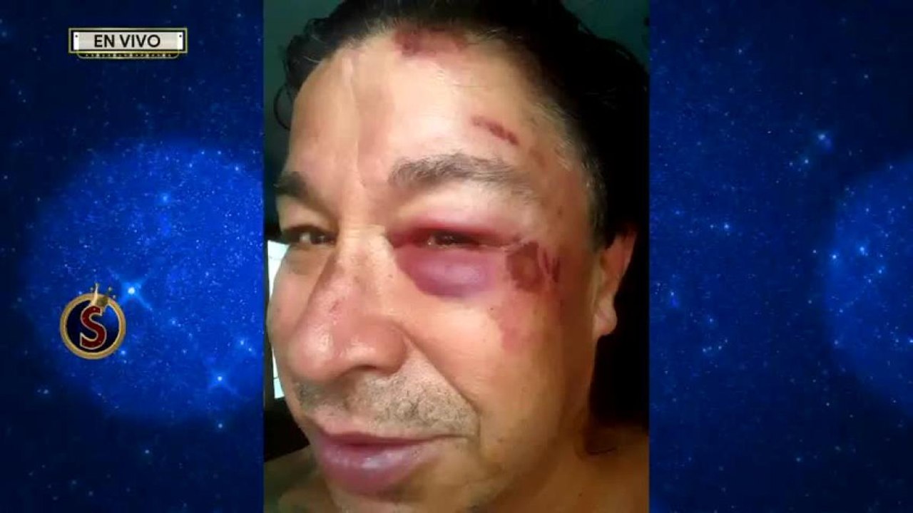 El TunTun recibió un fuerte golpe de calor