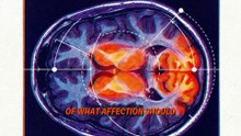 How Childhood Shapes Your Dating “Picker” | The Psychology Behind Attraction