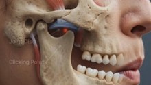 Why Does Your Jaw Click When You Chew? TMJ Explained