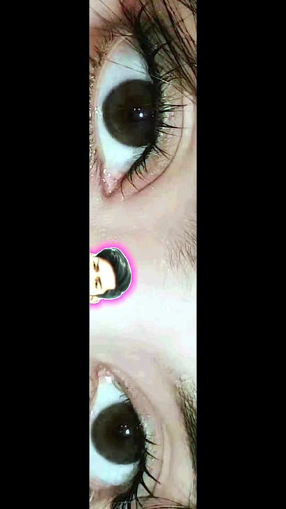 Viral