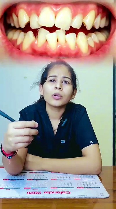 Veneers क्या होते हैं? 😲 Hollywood Smile का रा...