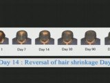 Profinast Anti Hair Loss Treatment www.Care-hair.net