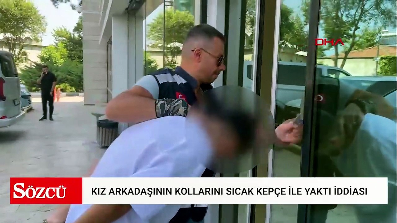 Kız arkadaşının kollarını sıcak yemek kepçesiyle yaktığı iddiasıyla gözaltına alındı