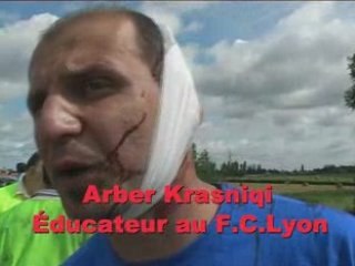 UN MORT DANS UN ACCIDENT DE BUS EN SAONE-ET-LOIRE