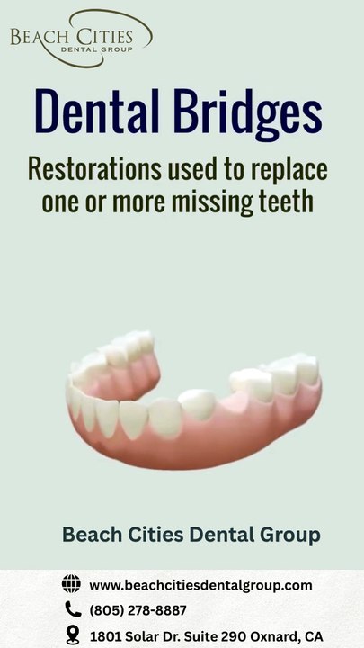 Dental Bridges Oxnard