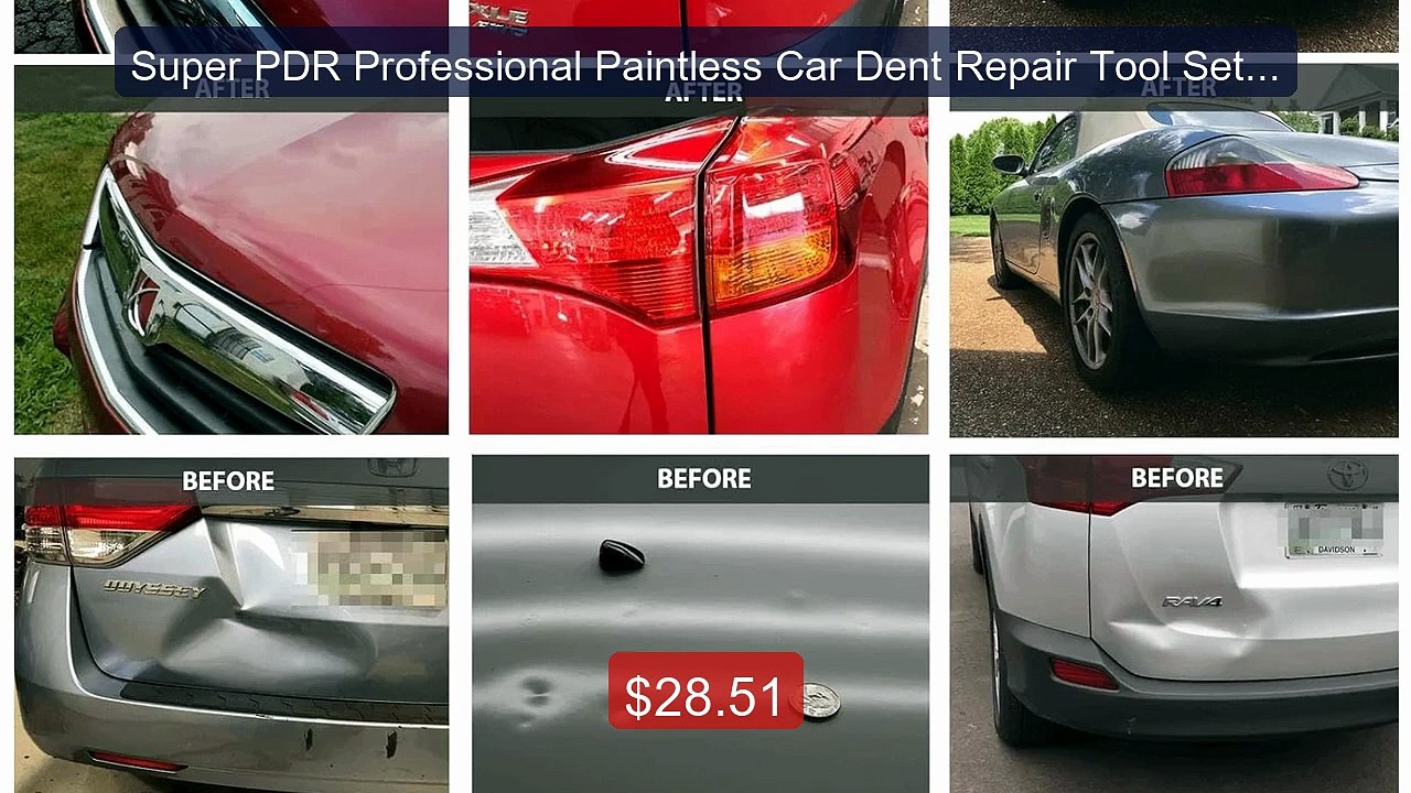 Super PDR Professional Paintless Car Dent Repair Tool Set for ... -- Best Buy 2026 | Great Quality!