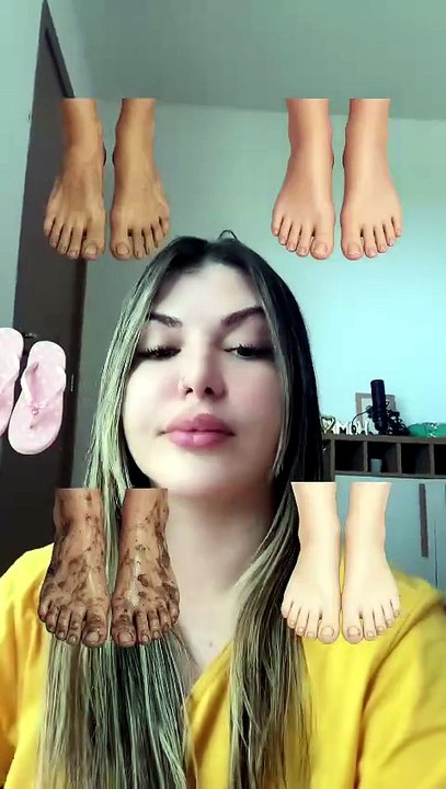 Check Out the Weirdest Feet Ever!