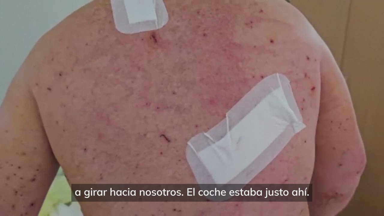 El verdulero ucranio cazado por un dron: "Intenté demostrar que solo tenía verduras"