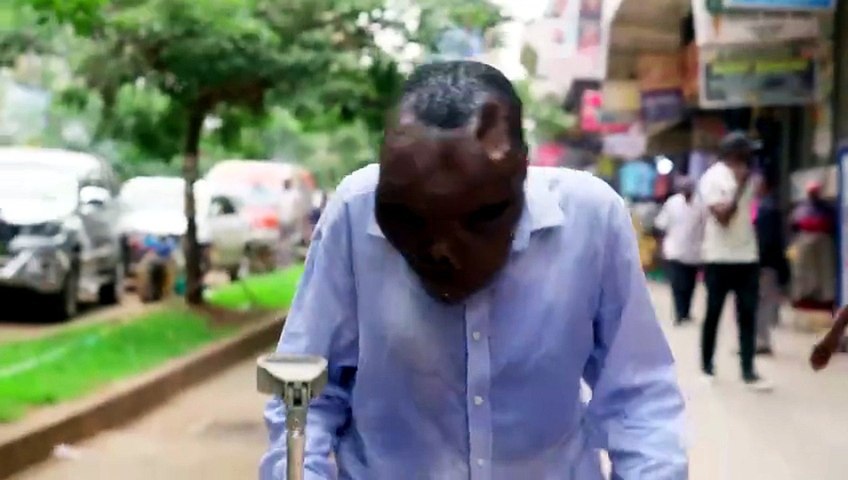 Most Extreme Humans S01E02 Ugliest Man [Full Movie]