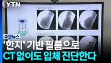 "CT 없이 입체진단 가능"...비법은 '한지' 기반 필름 / YTN