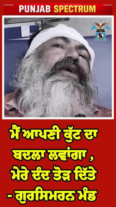 ਮੈਂ ਆਪਣੀ ਕੁੱਟ ਦਾ ਬਦਲਾ ਲਵਾਂਗਾ , ਮੇਰੇ ਦੰਦ ਤੋੜ ਦਿੱ
