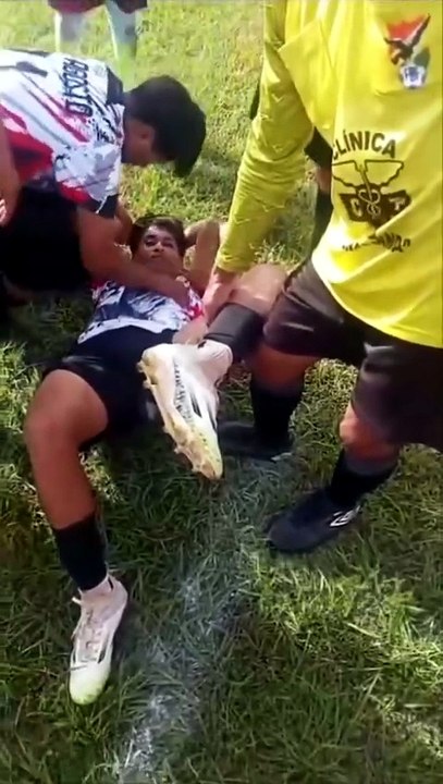 TERRIBLE LESIÓN EN URUBICHÁ