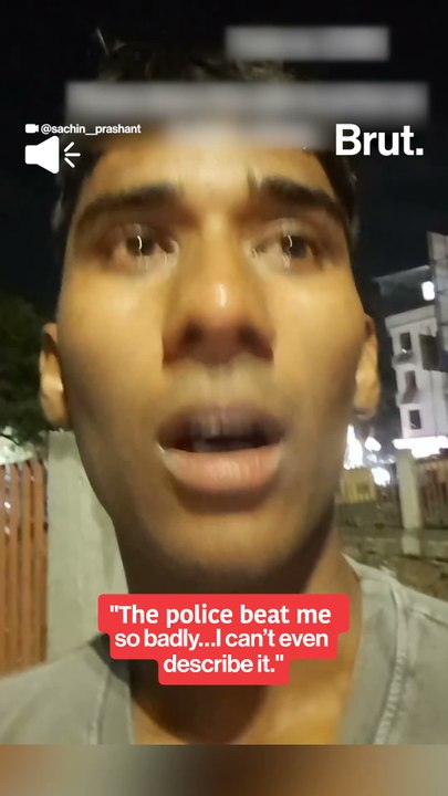 Youth alleges being beaten by railway police