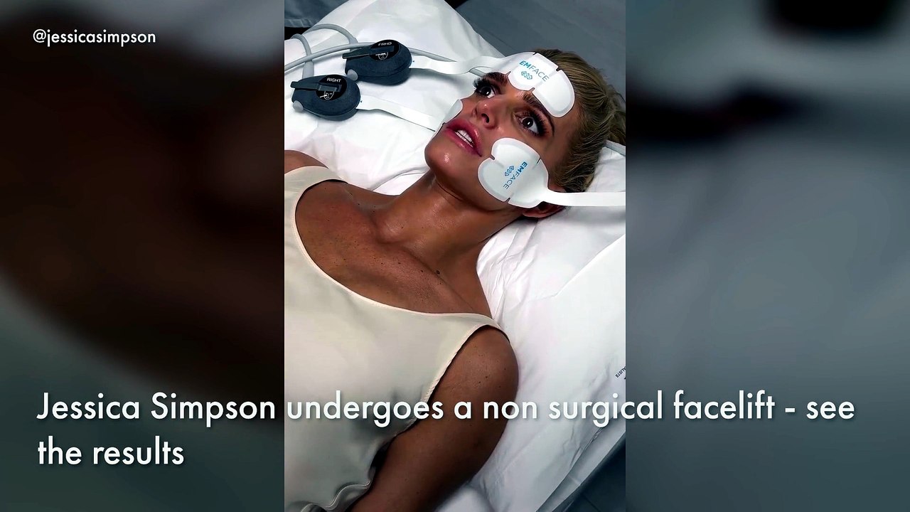 Jessica Simpson undergoes a non surgical faceli...