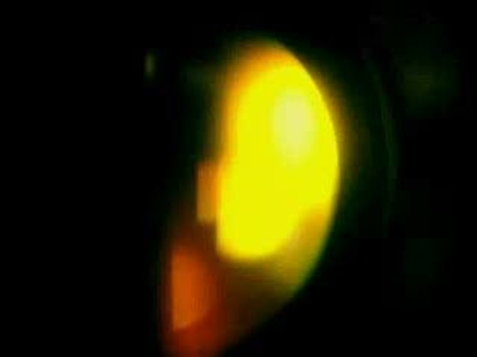 Habillage emission