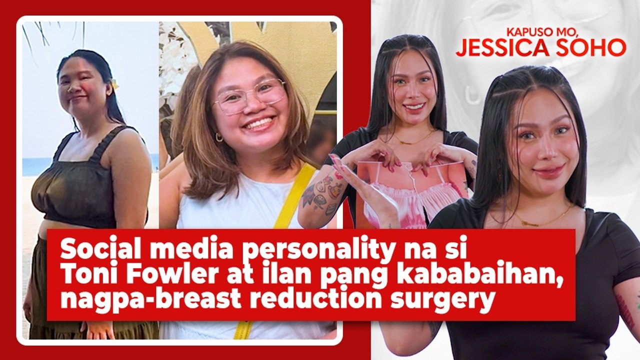 Toni Fowler at ilan pang kababaihan, nagpa-breast reduction surgery | Kapuso Mo, Jessica Soho