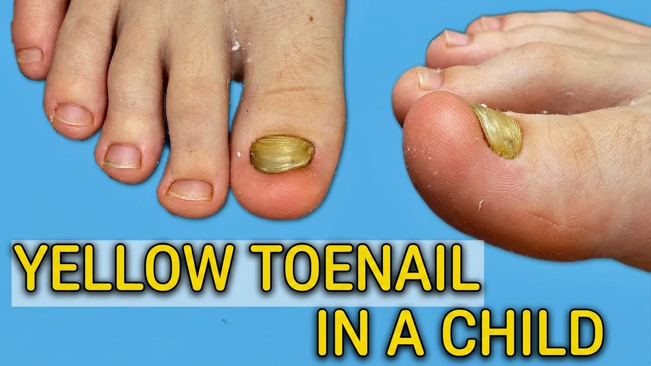 This Kid Was Self-Conscious About His Feet