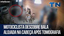 Motociclista descobre bala alojada na cabeça após tomografia