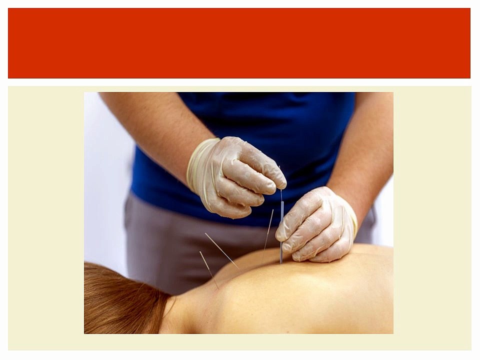Managing Back Pain: When Physiotherapy and Acupuncture May Help