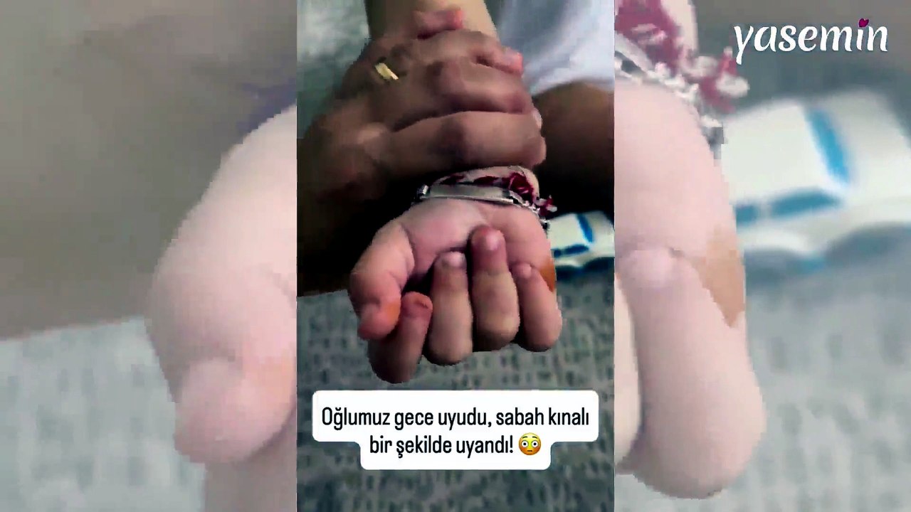 Sosyal medyada gündem oldu! Çocuğunun el ve ayaklarındaki renk değişiminin nedeni şaşırttı