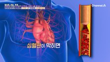 끈적한 피가 유발하는 심뇌혈관질환