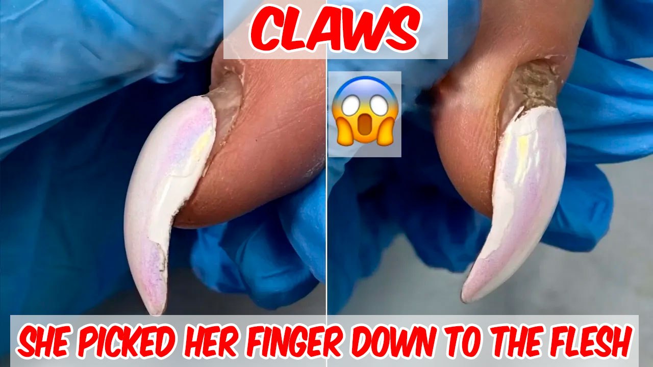 How to Fix Damaged Nails 🐔😱 Nail Vlog: Repairing Someone Else’s Work