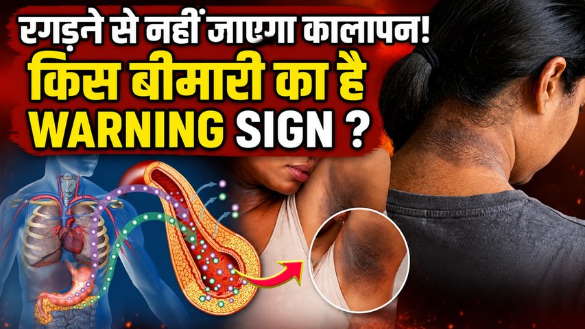 Neck Blackness Removal Tips: गर्दन का कालापन किस बीमारी का संकेत,कैसे ठीक करें ?