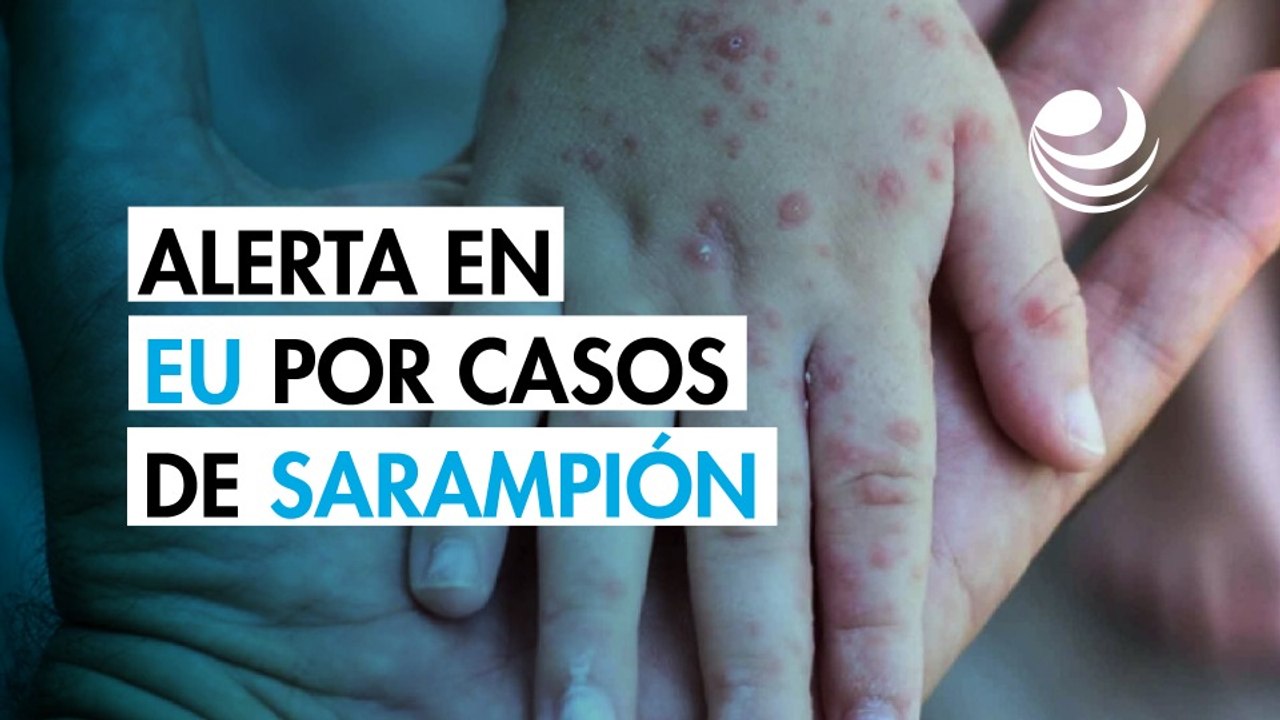 Pensilvania registra las primeras muertes por sarampión este año en Estados Unidos
