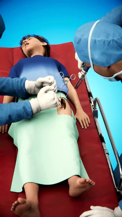 The Surgery That Makes A Leg Longer