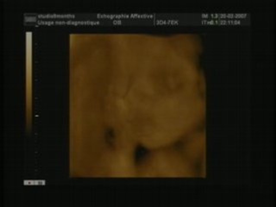 2cho affective de Sean mon doudou