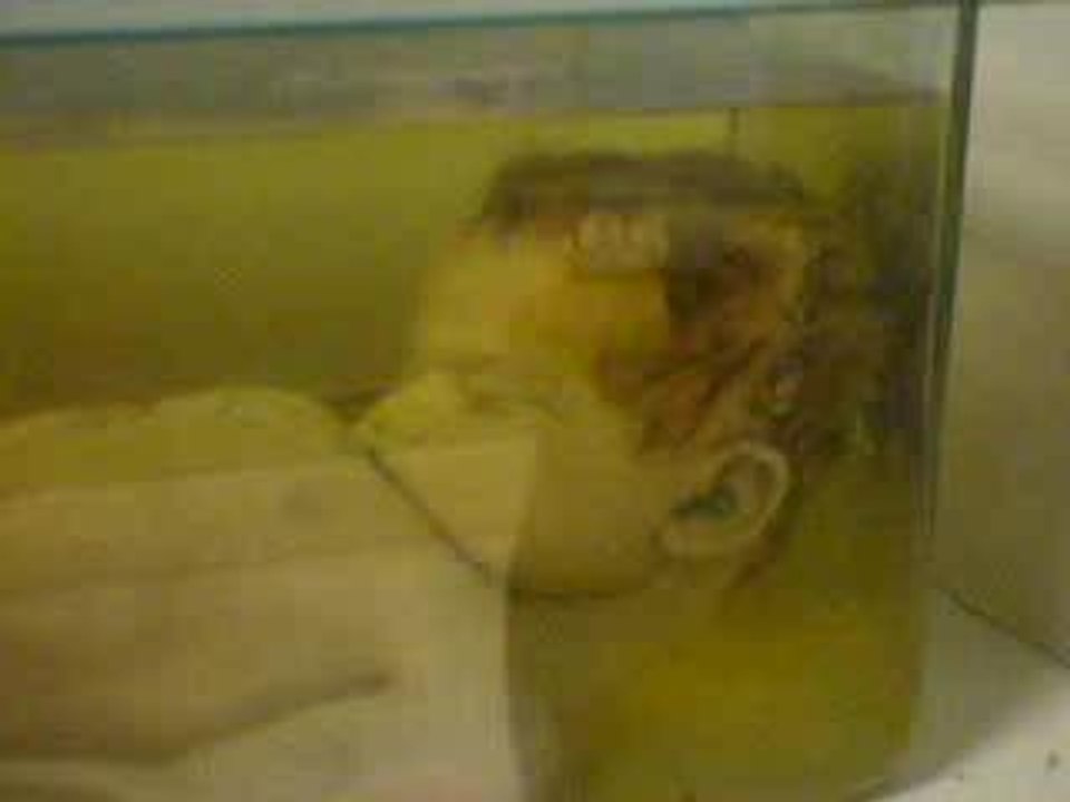 foetus