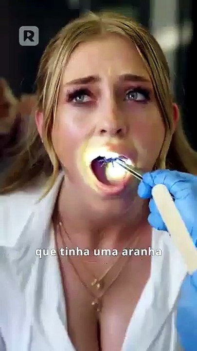 Minha visão de raio-x vê bem através de você série completa | ganzer film deutsch
