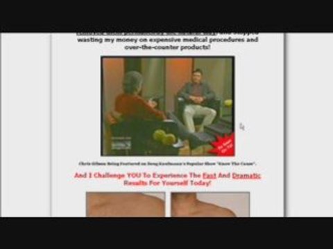 Get Rid Of Moles and Warts - In Just 3 Days!