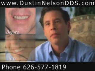 Smile Makeover Los Angeles