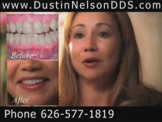 Smile Lift Los Angeles  | Smile Design in LA Dental Spa