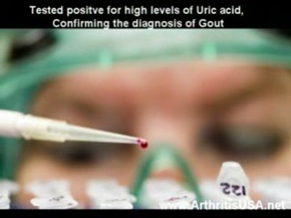 Dr Farshchian s Regenerative Medicine and knee pain